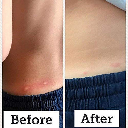 BabyBiotics - Topical Probiotic Body Care for Children, 4oz - Hypoallergenic, Vegan, 100% Natural