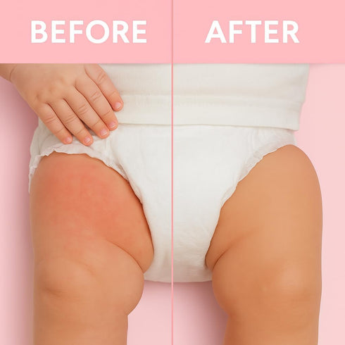 Generic 5 oz Medicated Body Powder with Zinc Oxide & Cornstarch, Talc-Free, Soothes & Protects Irritated Skin, Diaper