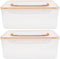 SOLUSTRE Breastmilk Storage Container Set 2PCS Freezer Organizer for Breastmilk Bags Leak-Resistant