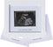 IHEIPYE Baby Sonogram Photo Frame - Ultrasound Picture Frame for Expecting Parents, Baby Showers, Nursery Decor (Silver