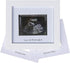 IHEIPYE Baby Sonogram Photo Frame - Ultrasound Picture Frame for Expecting Parents, Baby Showers, Nursery Decor (Silver
