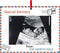 Pregnancy Announcement Christmas Ornament Sonogram Photo Frame Keepsake with Ribbon Baby Coming