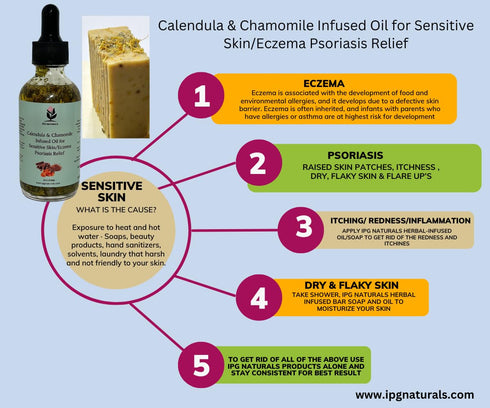 Calendula & Chamomile Oil for Eczema Relief - Sensitive Skin Care