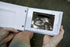 Pregnancy/Maternity Ultrasound and Photo Album/Keepsake for Memories
