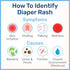 Penaten Medicated Creamy Diaper Rash Treatment, 113g