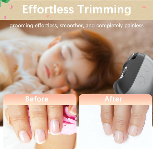 RIMOL 3-in-1 Trimmer Electric Nail Clipper with Polishing, Automatic Nail with LED Light & Nail Scraps Storage