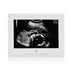 Little Blossoms Pearhead Love At First Sight Sonogram Picture Frame - Gender-Neutral Nursery Décor, 6.94x5.25x.75 Inch