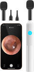 OTTOLIVES Baby Ear, Nose, Throat Examination Set with HD Camera, Home ENT