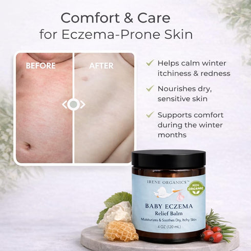 Irene Organics Baby Eczema Relief Balm, Healing Ointment Baby Moisturizing Cream for Eczema, Dry, Itchy Skin. Award