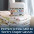 Recommended BabyEase - Diaper Rash Cream with Zinc Oxide and Aloe Vera - by Pediatricians and Pharmacists. Relief
