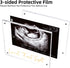 DEYIXUN Acrylic Ultrasound Picture Frame, Bright Photo Frame, Sonogram Love at First Sight Baby Keepsake Baby