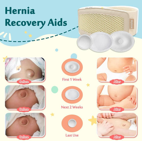 Mybow Umbilical Hernia Belt for Baby, Infant Belly Button Band, Adjustable Navel Band with 3 Compression Pads