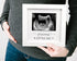 Set 2026 New Parents Gift Est Pregnancy Announcement Gifts for Couples-First Time New Mom Basket for Baby Shower Gender