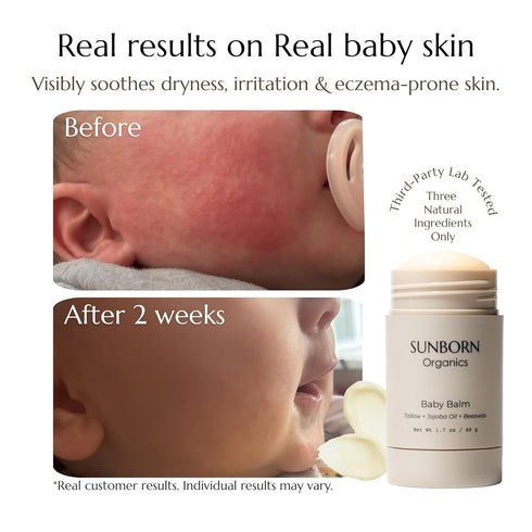 3 Baby Balm | Natural Ingredient Moisturizing Stick for Eczema Relief, Sensitive Skin & Diaper Rash | Grass-Fed Tallow