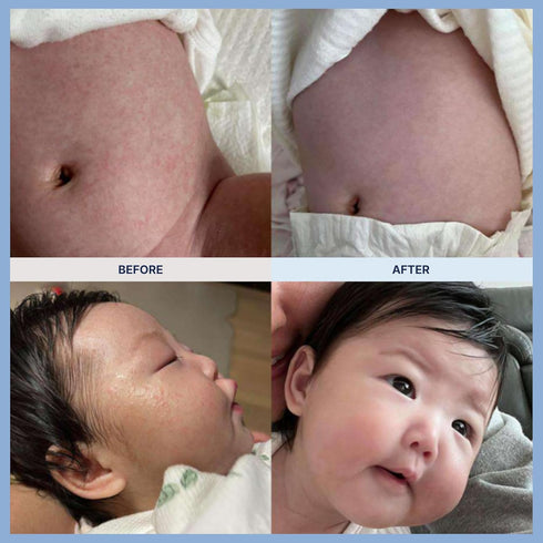 200 6 8.11 oz mongdies Baby Ato Cream | Hour Long Lasting Hydration | Patented Ceracine & Layer Ceramide Barrier Care |