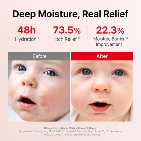 MLE 2.2 oz (65ml) ATOPALM | Eczema Cream | Premium Baby Lotion Newborn | Baby Face and Body Moisturizer for Skin