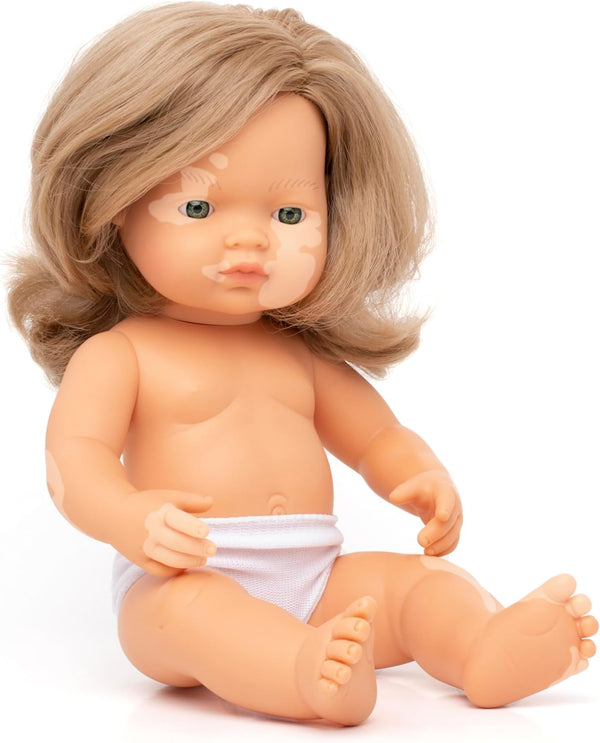 Miniland Doll 15'' Caucasian Girl with Vitiligo, Anatomically Correct Quality Toy Made in Spain