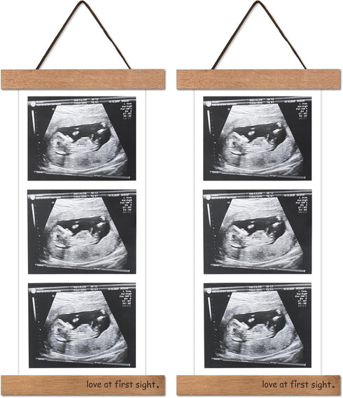 Zyeco 2 Pcs Sonogram Picture Frame, Wooden Magnetic Ultrasound Picture Frame for Refrigerator