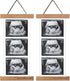 Zyeco 2 Pcs Sonogram Picture Frame, Wooden Magnetic Ultrasound Picture Frame for Refrigerator