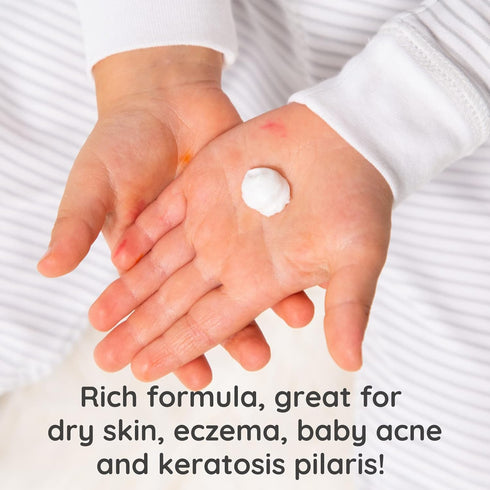 8oz) Bubbsi Whipped Coconut Oil Baby Lotion for Eczema, Dry Skin, Baby Acne, KP | Organic Coconut Oil, Shea Butter