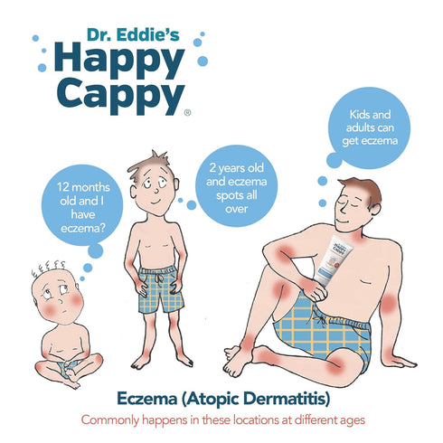 Happy Cappy Baby Shampoo and Body Wash for Eczema-Prone Skin, Fragrance Free for Infants, Toddlers, & Kids