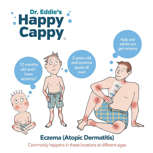 8 Oz (Pack 2) Happy Cappy Baby Shampoo and Body Wash - Eczema Body Wash for Kids & Toddlers, Helps with Dryness