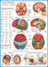 EuroGraphics Human Body (The Brain) 1000 Piece Puzzle