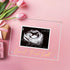 DEYIXUN Acrylic Ultrasound Picture Frame, Bright Photo Frame, Sonogram Love at First Sight Baby Keepsake Baby