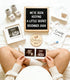Set Pregnancy Announcement, Baby Announcements Ideas Include Announcement Board, Baby Onesie, Baby Booties, Beanie Hat