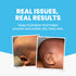 0+ 12 (1 100ml) Grahams Natural Baby Eczema Body and Bath Oil - Treat Eczema & Cradle Cap, Relief for Itchy, Dry Skin