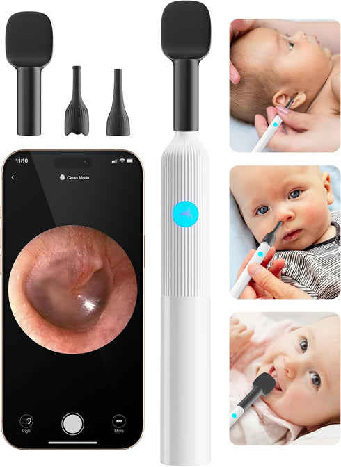 Set 6LED OTTOLIVES Baby Ear, Nose, Throat Examination with HD Camera, Home ENT Scope with Light, Ear Checker Tool, Baby