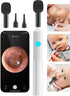 Set 6LED OTTOLIVES Baby Ear, Nose, Throat Examination with HD Camera, Home ENT Scope with Light, Ear Checker Tool, Baby