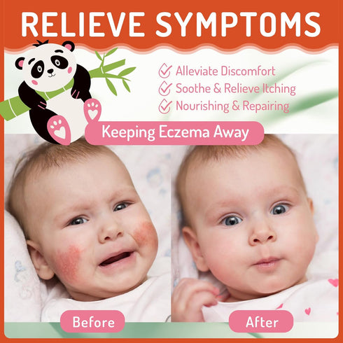 100ml/3.38oz Baby Eczema Cream for Kids, Eczema Therapy & Relief Body Lotion - Nourishing Skin Protectant, Soothes Dry