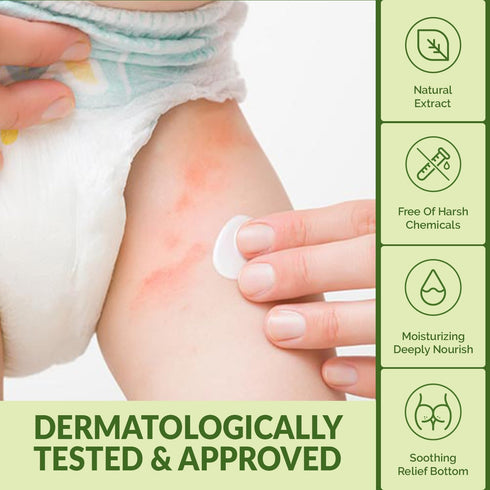 2.82 oz WBM Diaper Rash Cream | Baby Rash Relief Ointments Cream | Cruelty-Free, Hypoallergenic, Soothing, Moisturizing