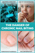 Nail Biting Prevention for Kids - Safe & Effective Thumb Sucking Deterrent, No Bite Nail Polish Pen for Age 3+