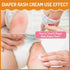 100ml/3.38oz Baby Diaper Rash Cream, for Prevent, Soothe and Treat Breakouts Diaper Rash and Flare-Ups, Instant