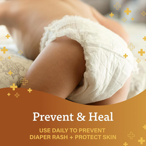 1.5 Packaging A+D Original Diaper Rash Ointment, Baby Skin Protectant with Lanolin and Petrolatum, Seals Out Wetness