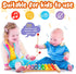 MCPINKY Xylophone for Kids, Educational Musical Toy with Child Safe Mallets for Toddlers 1-3