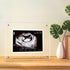 DEYIXUN Acrylic Ultrasound Picture Frame, Bright Photo Frame, Sonogram Love at First Sight Baby Keepsake Baby