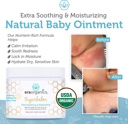 Era Organics Healing Ointment for Babies, USDA Organic Moisturizer, 4oz, Gentle on Sensitive Skin