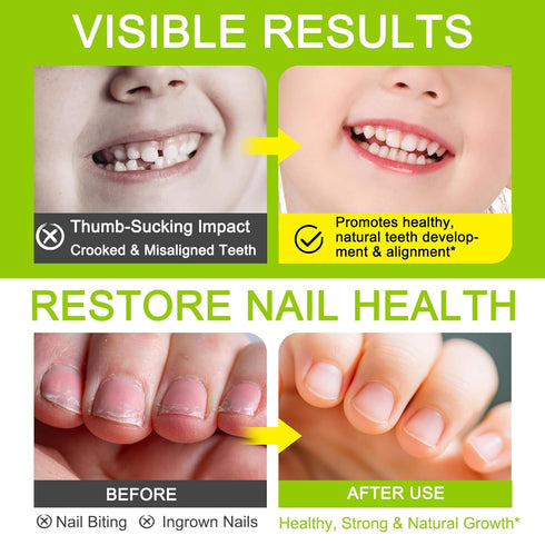 NIFEISHI (2pcs) Nails-0.24floz Nail Biting Treatment for Kids, Thumb Sucking Deterrent, Nail Biting Prevention