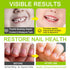 NIFEISHI (2pcs) Nails-0.24floz Nail Biting Treatment for Kids, Thumb Sucking Deterrent, Nail Biting Prevention