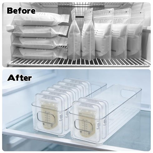 Wopgrty Breastmilk Storage Container, Freezer Flattener Kit, Breastmilk Storage Container, Plastic Storage Bins