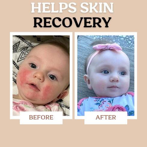 Power Pair Probiotic Baby Power Serum & Biome Barrier Cream - Hydrating, Soothing, Clean Ingredients