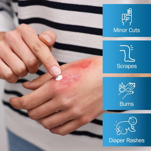 1 oz Zinc Oxide Ointment for Adults and Babies - Diaper Rash Ointment - Skin Protectant for Diaper Rashes, Cuts