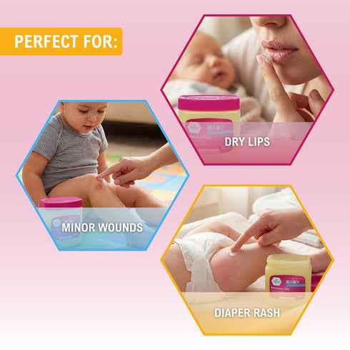 13 oz MED PRIDE Petroleum Jelly with Fresh Baby Scent, Pink, Skin Protectant & Moisturizing Ointment for Dry Skin