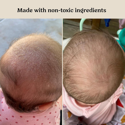 Roe Wellness Baby Hair, Scalp & Body Oil Unscented | Massage, Soothe, & Hydrates Irritated Skin | All Natural
