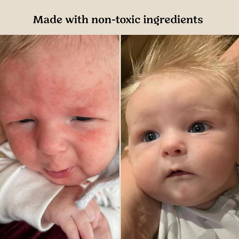 Roe Wellness- Baby Cream Lotion Ointment EWG Verified Non-Toxic Ingredients | Full Body Biome Barrier | Dry Skin, Itch
