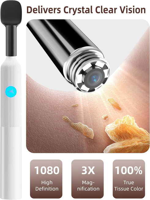 Set 6LED OTTOLIVES Baby Ear, Nose, Throat Examination with HD Camera, Home ENT Scope with Light, Ear Checker Tool, Baby
