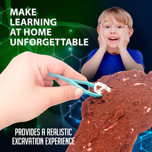 6 Dissect-It Discover-It Bigfoot Dig Kids Science Kit, Gel Dissection Kit for Kids to Learn Anatomy, STEM Toys for Ages